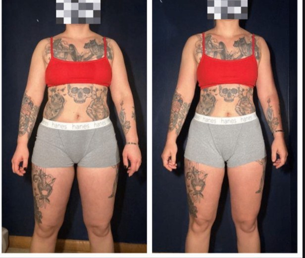 Elizabeth before and after transformation, Down 25 lbs in 1 year and 3 months