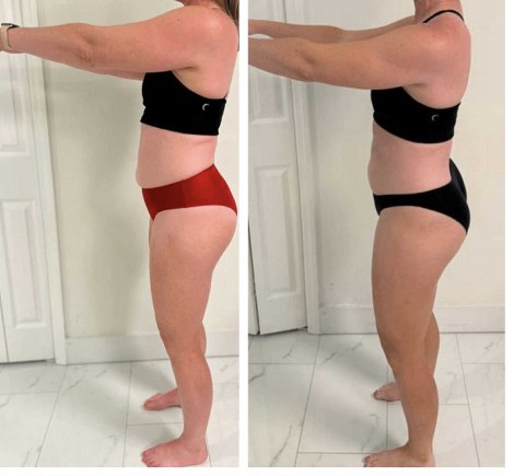 Drew before and after transformation, Down 10 lbs in 6 months while managing POTS